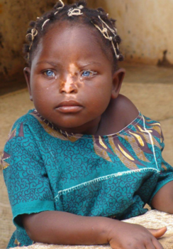 Malawi - You are beautiful just the way you are